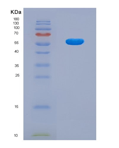 SDS-PAGE analysis of Mouse Prss8 (Prostasin) - Recombinant Protein, showing >90% purity under 15% SDS-PAGE (Reduced)