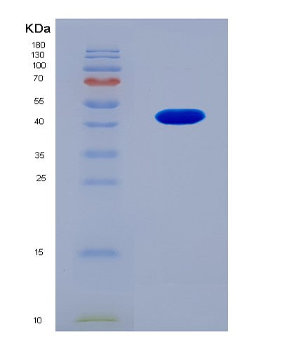 SDS-PAGE analysis of Human NEFH (Neurofilament Heavy Polypeptide) - Recombinant Protein, showing >90% purity under 15% SDS-PAGE (Reduced)
