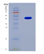 SDS-PAGE analysis of Human NEFH (Neurofilament Heavy Polypeptide) - Recombinant Protein, showing >90% purity under 15% SDS-PAGE (Reduced)