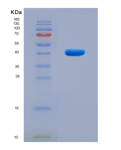 SDS-PAGE analysis of Human GNRHR (Gonadotropin-Releasing Hormone Receptor) - Recombinant Protein, showing >90% purity under 15% SDS-PAGE (Reduced)