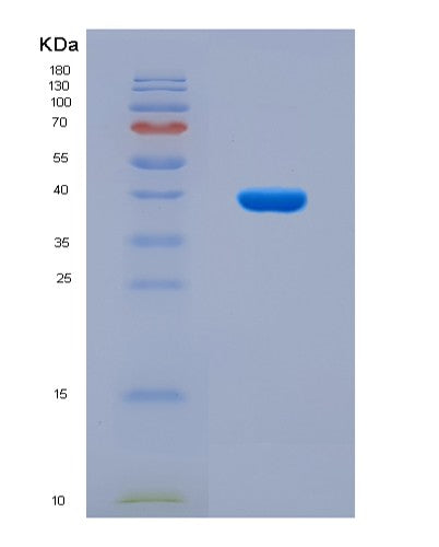 SDS-PAGE analysis of Human ESR1 (Estrogen Receptor) - Recombinant Protein, showing >90% purity under 15% SDS-PAGE (Reduced)