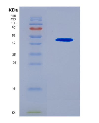 SDS-PAGE analysis of Human MVD (Diphosphomevalonate Decarboxylase) - Recombinant Protein, showing >90% purity under 15% SDS-PAGE (Reduced)