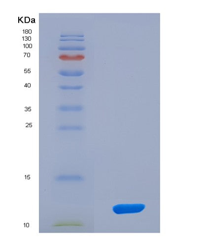 SDS-PAGE analysis of Human ESR2 (Estrogen Receptor Beta) - Recombinant Protein, showing >90% purity under 15% SDS-PAGE (Reduced)