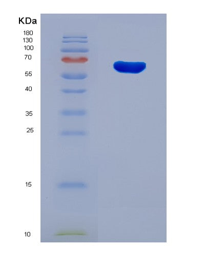 SDS-PAGE analysis of Human FTO (Alpha-Ketoglutarate-Dependent Dioxygenase Fto) - Recombinant Protein, showing >90% purity under 15% SDS-PAGE (Reduced)