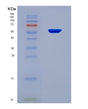 SDS-PAGE analysis of Human DCTN4 (Dynactin Subunit 4) - Recombinant Protein, showing >90% purity under 15% SDS-PAGE (Reduced)