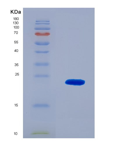 SDS-PAGE analysis of Human CPT1B (Carnitine O-Palmitoyltransferase 1, Muscle Isoform) - Recombinant Protein, showing >90% purity under 15% SDS-PAGE (Reduced)