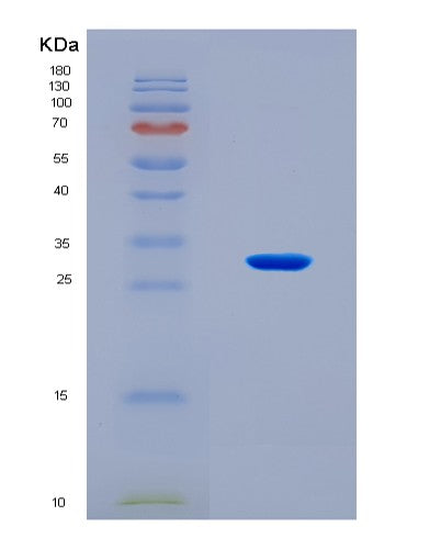 SDS-PAGE analysis of Human IRAK4 (Interleukin-1 Receptor-Associated Kinase 4) - Recombinant Protein, showing >90% purity under 15% SDS-PAGE (Reduced)