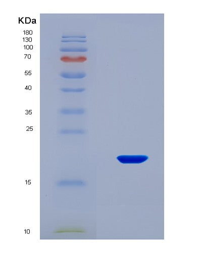 SDS-PAGE analysis of Human PDGFA (Platelet-Derived Growth Factor Subunit A) - Recombinant Protein, showing >90% purity under 15% SDS-PAGE (Reduced)