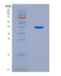 SDS-PAGE analysis of Human MAP1LC3B (Microtubule-Associated Protein 1 Light Chain 3 Beta) - Recombinant Protein, showing >90% purity under 15% SDS-PAGE (Reduced)
