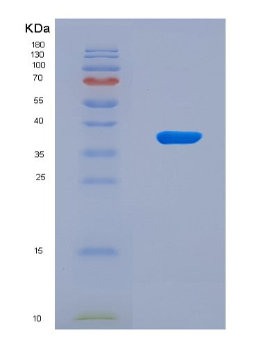 SDS-PAGE analysis of Human AQP1 (Aquaporin-1) - Recombinant Protein, showing >90% purity under 15% SDS-PAGE (Reduced)