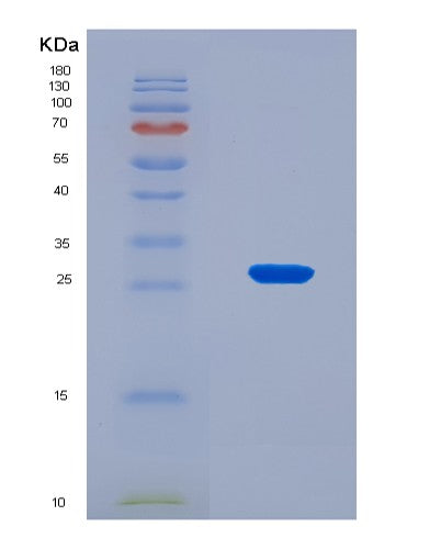 SDS-PAGE analysis of Human HGF (Hepatocyte Growth Factor) - Recombinant Protein, showing >90% purity under 15% SDS-PAGE (Reduced)