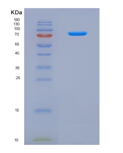 SDS-PAGE analysis of Human CAMK2B (Calcium/Calmodulin-Dependent Protein Kinase Type Ii Subunit Beta) - Recombinant Protein, showing >90% purity under 15% SDS-PAGE (Reduced)