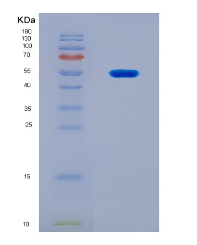 SDS-PAGE analysis of Human ATP2A2 (Sarcoplasmic/Endoplasmic Reticulum Calcium Atpase 2) - Recombinant Protein, showing >90% purity under 15% SDS-PAGE (Reduced)