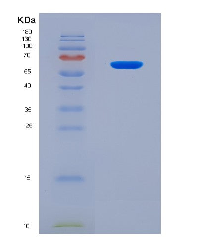 SDS-PAGE analysis of Human GSK3B (Glycogen Synthase Kinase-3 Beta) - Recombinant Protein, showing >90% purity under 15% SDS-PAGE (Reduced)