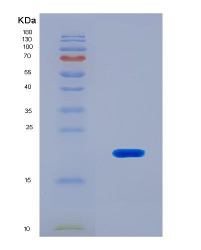 SDS-PAGE analysis of Human FCGBP (Iggfc-Binding Protein) - Recombinant Protein, showing >90% purity under 15% SDS-PAGE (Reduced)