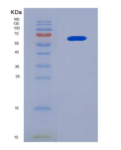 SDS-PAGE analysis of Mouse Gck (Hexokinase-4) - Recombinant Protein, showing >90% purity under 15% SDS-PAGE (Reduced)