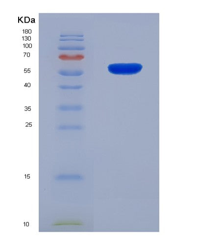 SDS-PAGE analysis of Human MMP1 (Interstitial Collagenase) - Recombinant Protein, showing >90% purity under 15% SDS-PAGE (Reduced)