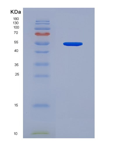 SDS-PAGE analysis of Mouse Dnmt1 (Dna (Cytosine-5)-Methyltransferase 1) - Recombinant Protein, showing >90% purity under 15% SDS-PAGE (Reduced)
