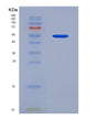 SDS-PAGE analysis of Mouse Dnmt1 (Dna (Cytosine-5)-Methyltransferase 1) - Recombinant Protein, showing >90% purity under 15% SDS-PAGE (Reduced)