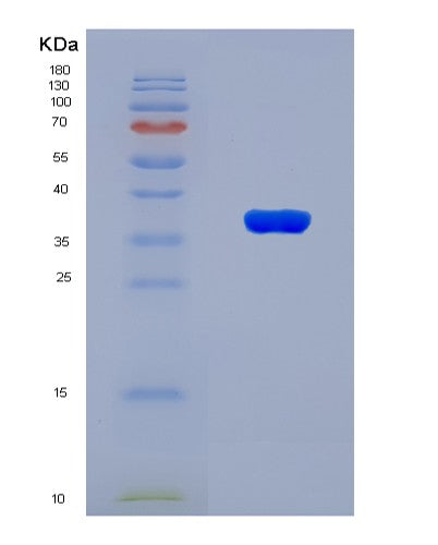 SDS-PAGE analysis of Human SPARC (Sparc) - Recombinant Protein, showing >90% purity under 15% SDS-PAGE (Reduced)