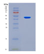 SDS-PAGE analysis of Human ULK1 (Serine/Threonine-Protein Kinase Ulk1) - Recombinant Protein, showing >90% purity under 15% SDS-PAGE (Reduced)