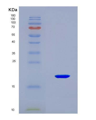 SDS-PAGE analysis of Mouse Sod1 (Superoxide Dismutase [Cu-Zn]) - Recombinant Protein, showing >90% purity under 15% SDS-PAGE (Reduced)