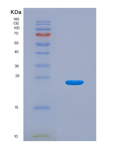 SDS-PAGE analysis of Mouse Calr (Calreticulin) - Recombinant Protein, showing >90% purity under 15% SDS-PAGE (Reduced)