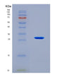 SDS-PAGE analysis of Human CLEC9A (C-Type Lectin Domain Family 9 Member A) - Recombinant Protein, showing >90% purity under 15% SDS-PAGE (Reduced)