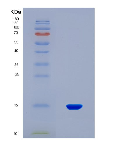 SDS-PAGE analysis of Human INHBA (Inhibin Beta A Chain) - Recombinant Protein, showing >90% purity under 15% SDS-PAGE (Reduced)