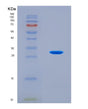 SDS-PAGE analysis of Human LY96 (Lymphocyte Antigen 96) - Recombinant Protein, showing >90% purity under 15% SDS-PAGE (Reduced)