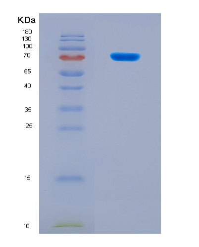 SDS-PAGE analysis of Human PKMYT1 (Membrane-Associated Tyrosine- And Threonine-Specific Cdc2-Inhibitory Kinase) - Recombinant Protein, showing >90% purity under 15% SDS-PAGE (Reduced)