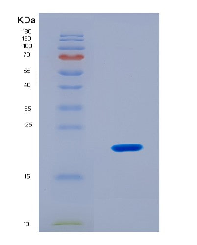 SDS-PAGE analysis of Human Mothers against decapentaplegic homolog 3(SMAD3) - Recombinant Protein, showing >90% purity under 15% SDS-PAGE (Reduced)
