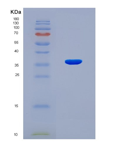 SDS-PAGE analysis of Human TRIM2 (Tripartite Motif-Containing Protein 2) - Recombinant Protein, showing >90% purity under 15% SDS-PAGE (Reduced)
