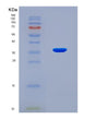 SDS-PAGE analysis of Human TRIM2 (Tripartite Motif-Containing Protein 2) - Recombinant Protein, showing >90% purity under 15% SDS-PAGE (Reduced)