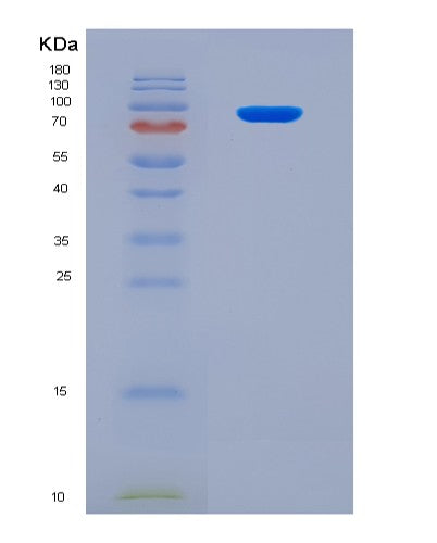 SDS-PAGE analysis of Human WEE1 (Wee1-Like Protein Kinase) - Recombinant Protein, showing >90% purity under 15% SDS-PAGE (Reduced)