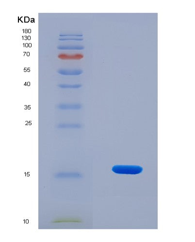 SDS-PAGE analysis of Human HIGD1A (Hig1 Domain Family Member 1A, Mitochondrial) - Recombinant Protein, showing >90% purity under 15% SDS-PAGE (Reduced)
