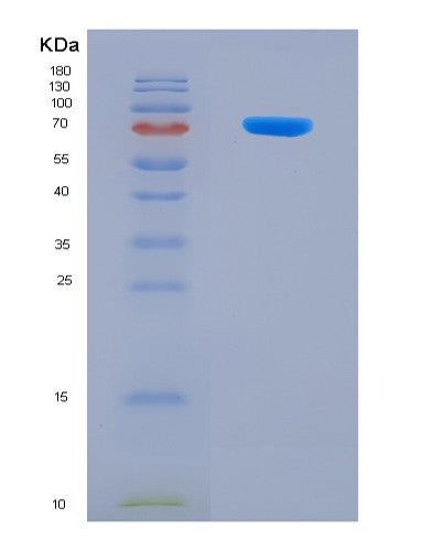 SDS-PAGE analysis of Mouse Gad2 (Glutamate Decarboxylase 2) - Recombinant Protein, showing >90% purity under 15% SDS-PAGE (Reduced)