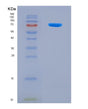 SDS-PAGE analysis of Mouse Gad2 (Glutamate Decarboxylase 2) - Recombinant Protein, showing >90% purity under 15% SDS-PAGE (Reduced)