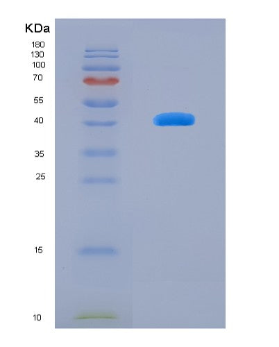 SDS-PAGE analysis of Human B-Lymphocyte Chemoattractant (BLC) - Recombinant Protein, showing >90% purity under 15% SDS-PAGE (Reduced)