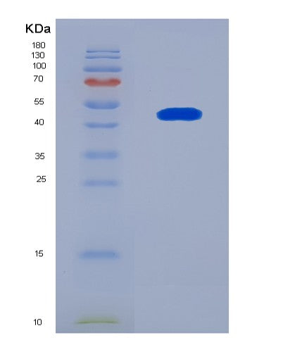 SDS-PAGE analysis of Human BRAF (Serine/Threonine-Protein Kinase B-Raf) - Recombinant Protein, showing >90% purity under 15% SDS-PAGE (Reduced)