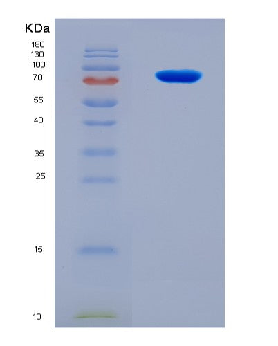 SDS-PAGE analysis of Human CHM (Rab Proteins Geranylgeranyltransferase Component A 1) - Recombinant Protein, showing >90% purity under 15% SDS-PAGE (Reduced)
