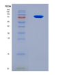 SDS-PAGE analysis of Human CHM (Rab Proteins Geranylgeranyltransferase Component A 1) - Recombinant Protein, showing >90% purity under 15% SDS-PAGE (Reduced)