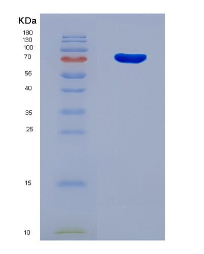SDS-PAGE analysis of Human RABGGTA (Geranylgeranyl Transferase Type-2 Subunit Alpha) - Recombinant Protein, showing >90% purity under 15% SDS-PAGE (Reduced)