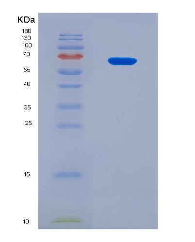 SDS-PAGE analysis of Mouse Efemp1 (Egf-Containing Fibulin-Like Extracellular Matrix Protein 1) - Recombinant Protein, showing >90% purity under 15% SDS-PAGE (Reduced)