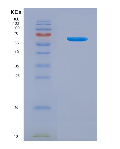 SDS-PAGE analysis of Human KRT18 (Keratin, Type I Cytoskeletal 18) - Recombinant Protein, showing >90% purity under 15% SDS-PAGE (Reduced)