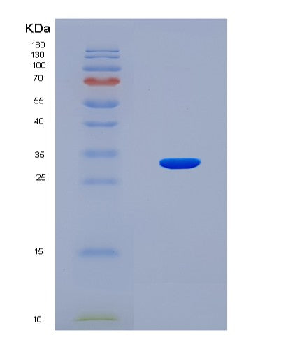 SDS-PAGE analysis of Mouse Tnfaip6 (Tumor Necrosis Factor-Inducible Gene 6 Protein) - Recombinant Protein, showing >90% purity under 15% SDS-PAGE (Reduced)