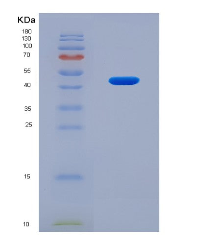 SDS-PAGE analysis of Human TNFAIP6 (Tumor Necrosis Factor-Inducible Gene 6 Protein) - Recombinant Protein, showing >90% purity under 15% SDS-PAGE (Reduced)