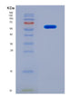 SDS-PAGE analysis of Mouse Nrbf2 (Nuclear Receptor-Binding Factor 2) - Recombinant Protein, showing >90% purity under 15% SDS-PAGE (Reduced)
