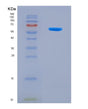 SDS-PAGE analysis of Mouse Nptx2 (Neuronal Pentraxin-2) - Recombinant Protein, showing >90% purity under 15% SDS-PAGE (Reduced)