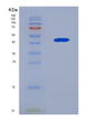 SDS-PAGE analysis of Mouse Lcn2 (Neutrophil Gelatinase-Associated Lipocalin) - Recombinant Protein, showing >90% purity under 15% SDS-PAGE (Reduced)